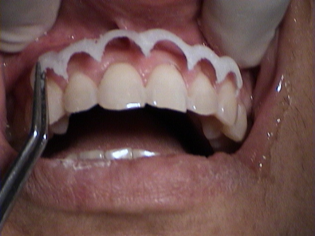 SolaIndia Laser Dentistry
